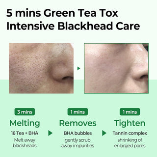 🤍TIME SALE🤍 [SomeByMi] BYE BYE BLACKHEAD 30 DAYS MIRACLE GREEN TEA TOX BUBBLE CLEANSER 120g